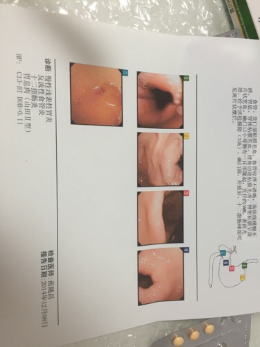 南微医学获得实用新型专利授权:“一种冷热套圈器及黏膜切除手术器械”